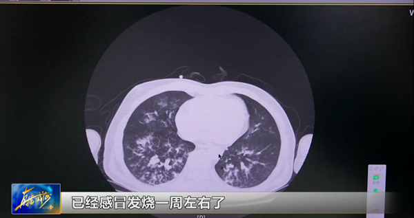 直2.png